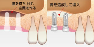 図１